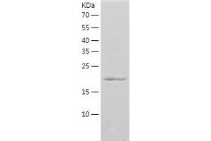 Western Blotting (WB) image for Family with Sequence Similarity 3, Member A (FAM3A) (AA 34-230) protein (His tag) (ABIN7286878) (FAM3A Protein (AA 34-230) (His tag))