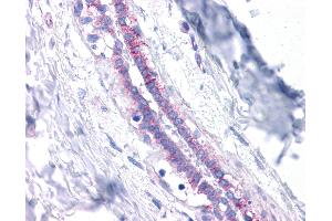 Anti-E Cadherin antibody IHC of human breast. (E-cadherin antibody  (AA 503-552))