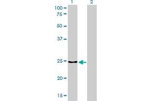 Western Blot analysis of CLTB expression in transfected 293T cell line by CLTB monoclonal antibody (M01), clone 4B12-1E3.