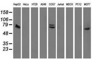Image no. 3 for anti-SAM Domain and HD Domain 1 (SAMHD1) antibody (ABIN1500800) (SAMHD1 antibody)