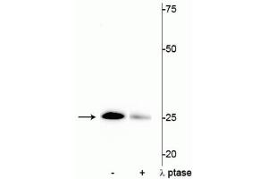 Western blot of mouse heart lysate showing specific immunolabeling of the ~25 kDa cardiac troponin I protein phosphorylated at Ser43 in the first lane (-). (TNNI3 antibody  (pSer43))