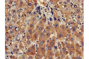 Immunohistochemistry of paraffin-embedded human liver tissue using ABIN7147821 at dilution of 1:100 (Clarin 2 antibody  (AA 31-100))