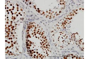 Immunoperoxidase of monoclonal antibody to CSTF3 on formalin-fixed paraffin-embedded human testis.