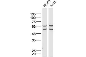 Lane 1: HL-60 Cell lysates; Lane 2: A431 Cell lysates; probed with Natriuretic Peptide Receptor C Polyclonal Antibody, unconjugated (bs-2333R) at 1:300 overnight at 4°C followed by a conjugated secondary antibody for 60 minutes at 37°C. (NPR3 antibody  (AA 301-400))