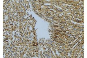 ABIN6273022 at 1/100 staining Mouse kidney tissue by IHC-P. (TTL antibody)