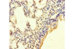 Immunohistochemistry of paraffin-embedded human lung tissue using ABIN7165887 at dilution of 1:100 (SGK196 antibody  (AA 44-350))