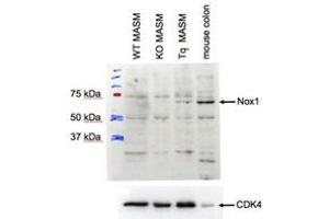 Western Blotting (WB) image for anti-NADPH Oxidase 1 (NOX1) (Internal Region) antibody (ABIN2464425)