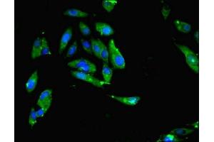 Immunofluorescent analysis of Hela cells using ABIN7159642 at dilution of 1:100 and Alexa Fluor 488-congugated AffiniPure Goat Anti-Rabbit IgG(H+L) (MTHFR antibody  (AA 1-656))