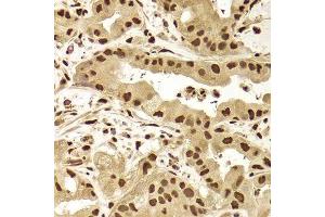 Immunohistochemistry (Paraffin-embedded Sections) (IHC (p)) image for anti-Acidic (Leucine-Rich) Nuclear phosphoprotein 32 Family, Member A (ANP32A) (AA 1-170) antibody (ABIN6136909)
