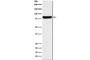 Western blot analysis of GUSB expression in K562 cell lysate.