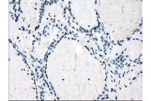 Image no. 4 for anti-P450 (Cytochrome) Oxidoreductase (POR) antibody (ABIN1497746) (POR antibody)