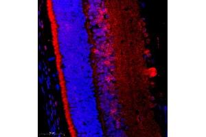 Immunofluorescence of paraffin embedded rat eye using FGF11 (ABIN7073941) at dilution of 1:2200 (400x lens) (FGF11 antibody)