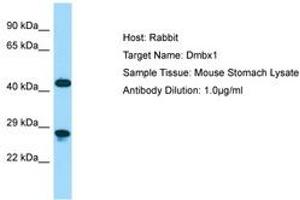 Image no. 1 for anti-Diencephalon/mesencephalon Homeobox 1 (DMBX1) (C-Term) antibody (ABIN6749863) (DMBX1 antibody  (C-Term))