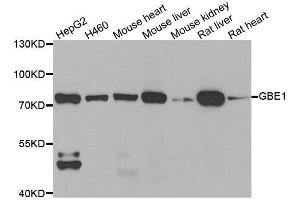 Western blot analysis of extracts of various cell lines, using GBE1 antibody. (GBE1 antibody  (AA 1-300))