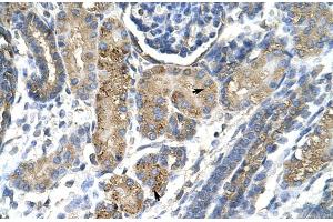 Human kidney (SLUG antibody  (Middle Region))