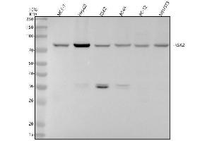 Western blot analysis of RSK2 using anti-RSK2 antibody (ABIN7606217).