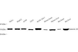 Western blot analysis of Annexin-A4 (ABIN7073066) at dilution of 1: 500 (Annexin IV antibody)