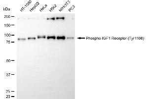 Western blotting analysis using phospho-IGF1 Receptor (Tyr) antibody (ABIN7799048).
