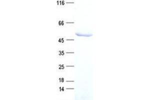 Validation with Western Blot