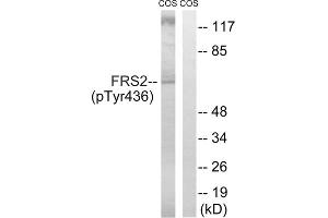 Western blot analysis of extracts from COS cells, using FRS2 (Phospho-Tyr436) antibody. (FRS2 antibody  (pTyr436))