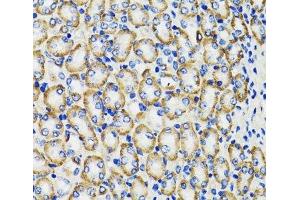 Immunohistochemistry of paraffin-embedded Rat kidney using COMT Polyclonal Antibody at dilution of 1:100 (40x lens).