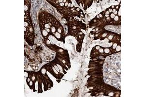 Immunohistochemical staining of human colon with CGN polyclonal antibody  shows strong cytoplasmic and membranous positivity in glandular cells at 1:50-1:200 dilution. (Cingulin antibody)