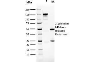 SDS-PAGE Analysis Purified PDZ and LIM Domain 1 Mouse Monoclonal Antibody (PDLIM-1). (PDLIM1 antibody)