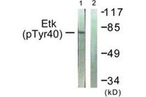 Western blot analysis of extracts from HepG2 cells, using ETK (Phospho-Tyr40) Antibody. (BMX antibody  (pTyr40))