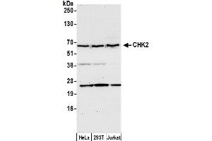 Western Blotting (WB) image for anti-Checkpoint Kinase 2 (CHEK2) (C-Term) antibody (ABIN7450118)