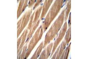 Immunohistochemistry analysis in formalin fixed and paraffin embedded human skeletal muscle reacted with PIP5KL1 Antibody (N-term) followed by peroxidase conjugation of the secondary antibody and DAB staining. (PIP5KL1 antibody  (N-Term))