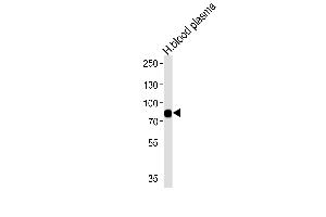 Western blot analysis of lysates from human blood plasma tissue (from left to right),using LRRC45 Antibody (C-term) (ABIN655315 and ABIN2844894). (LRRC45 antibody  (C-Term))