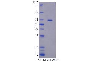 Image no. 1 for ATP-Binding Cassette, Sub-Family B (MDR/TAP), Member 8 (ABCB8) (AA 472-735) protein (ABIN6239398) (ABCB8 Protein (AA 472-735))