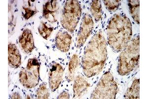 Immunohistochemical analysis of paraffin-embedded stomach tissues using MUC5AC mouse mAb with DAB staining. (MUC5AC antibody  (AA 5528-5627))