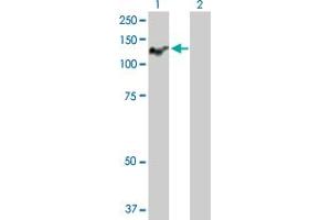 Western Blot analysis of ATP2C1 expression in transfected 293T cell line by ATP2C1 MaxPab polyclonal antibody. (ATP2C1 antibody  (AA 1-919))