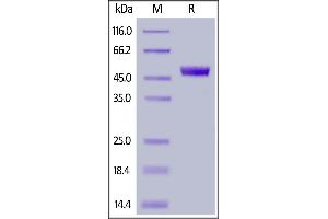 Fed Human CD4, His Tag on  under reducing (R) condition.