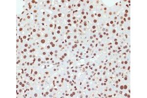 Immunohistochemistry of paraffin-embedded Mouse liver using Phospho-POLR2A(S5) Polyclonal Antibody at dilution of 1:100 (40x lens). (POLR2A/RPB1 antibody  (pSer5))