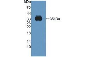 Detection of Recombinant CYBb, Human using Polyclonal Antibody to Cytochrome b-245 Beta Polypeptide (CYBb) (CYBB antibody  (AA 283-570))