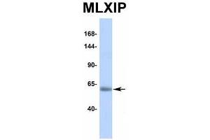 Host:  Rabbit  Target Name:  MLXIP  Sample Type:  Human Adult Placenta  Antibody Dilution:  1. (MLXIP antibody  (Middle Region))