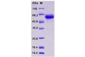 Western Blotting (WB) image for Tumor Necrosis Factor Receptor Superfamily, Member 1A (TNFRSF1A) (Active) protein (Fc Tag) (ABIN7321201) (TNFRSF1A Protein (Fc Tag))