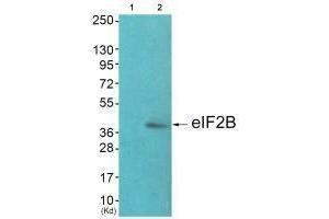 Western blot analysis of extracts from JK cells (Lane 2), using eIF2B (Ab-67) antiobdy. (EIF2S2 antibody  (N-Term))