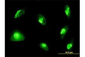 Immunofluorescence of purified MaxPab antibody to GOLGA2 on HepG2 cell. (Golgin A2 (GOLGA2) (AA 1-990) antibody)