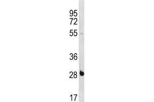 RBPMS antibody western blot analysis in NCI-H460 lysate. (RBPMS antibody  (AA 166-193))