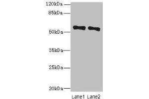 Western blot All lanes: ZNF689 antibody at 5 μg/mL Lane 1: Hela whole cell lysate Lane 2: HepG2 whole cell lysate Secondary Goat polyclonal to rabbit IgG at 1/10000 dilution Predicted band size: 57 kDa Observed band size: 57 kDa (ZNF689 antibody  (AA 1-300))