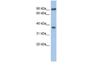 WB Suggested Anti-RSPH10B Antibody Titration: 0. (RSPH10B antibody  (Middle Region))