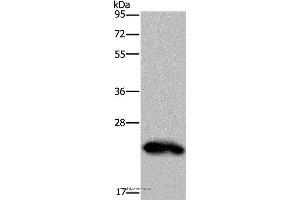 Western blot analysis of Human placenta tissue, using GH2 Polyclonal Antibody at dilution of 1:500 (Growth Hormone 2 antibody)