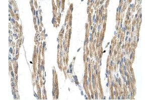 GPT antibody was used for immunohistochemistry at a concentration of 4-8 ug/ml to stain Skeletal muscle cells (arrows) in Human Muscle. (ALT antibody)