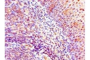 Immunohistochemistry of paraffin-embedded human tonsil tissue using ABIN7169428 at dilution of 1:100 (ASH2L antibody  (AA 329-628))