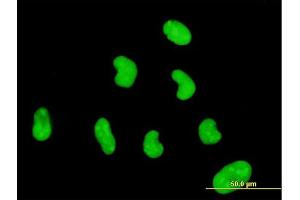 Immunofluorescence of monoclonal antibody to ZNF394 on HeLa cell. (ZNF394 antibody  (AA 1-561))