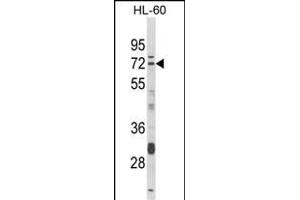Western blot analysis of DTX4 Antibody (N-term) (ABIN652817 and ABIN2842533) in HL-60 cell line lysates (35 μg/lane). (Deltex Homolog 4 antibody  (N-Term))