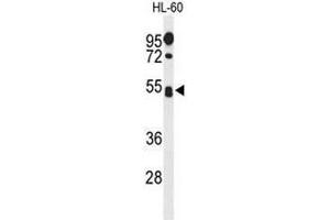 Western blot analysis of SPN Antibody (Center) in HL-60 cell line lysates (35µg/lane). (CD43 antibody  (Middle Region))